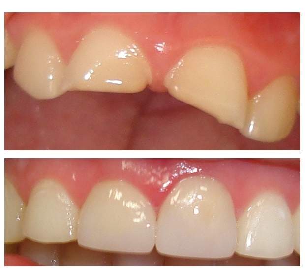 Before and after Simcoe dentist 3
