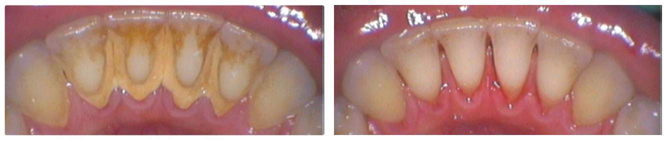 Dental Hygiene 3
